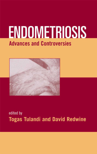 Endometriosis: Advances and Controversies