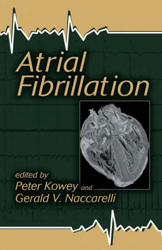 Atrial Fibrillation (Fundamental and Clinical Cardiology)