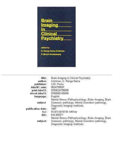 Brain imaging in clinical psychiatry