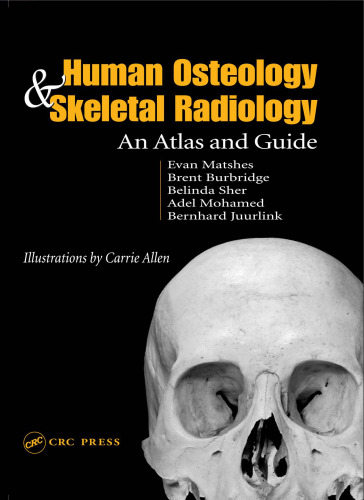 Human Osteology and Skeletal Radiology: An Atlas and Guide