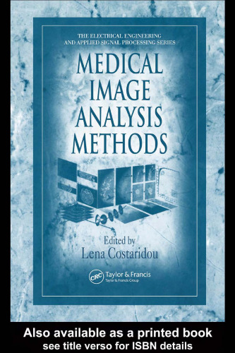 Medical Image Analysis Methods (Electrical Engineering & Applied Signal Processing)