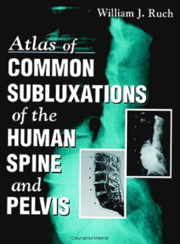 Atlas of Common Subluxations of the Human Spine and Pelvis