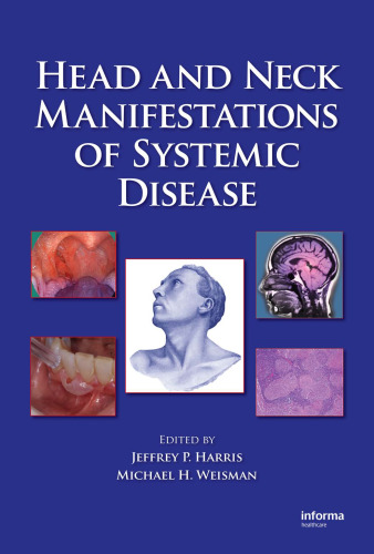 Head and Neck Manifestations of Systemic Disease