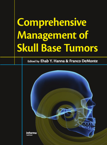 Comprehensive Management of Skull Base Tumors