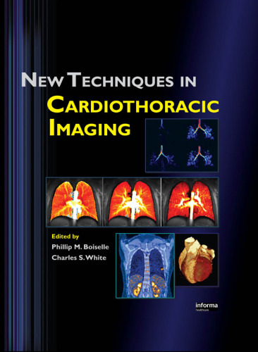 New Techniques in Cardiothoracic Imaging