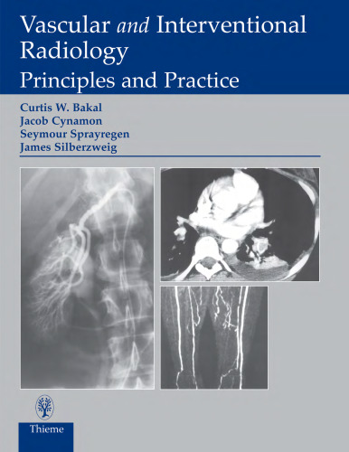 Vascular and interventional radiology: principles and practice