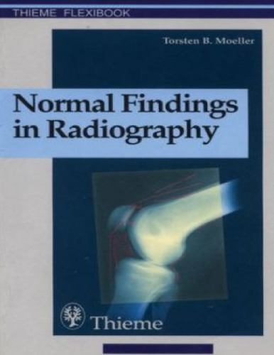 Normal Findings in Radiography