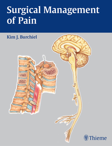 Surgical management of pain