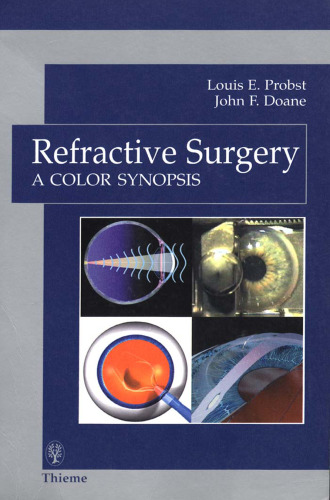 Refractive surgery: a color synopsis