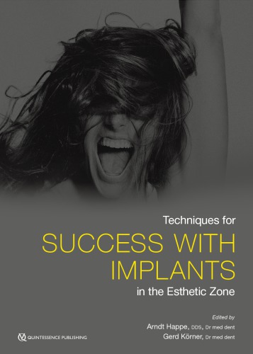 Techniques for Success With Implants in the Esthetic Zone
