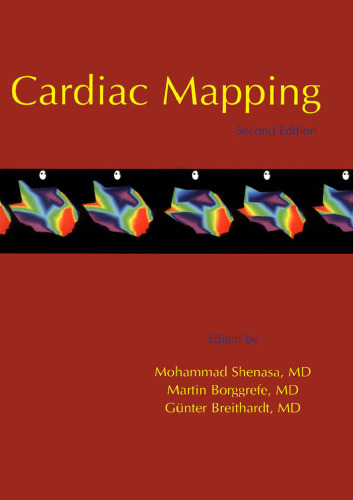 Cardiac Mapping