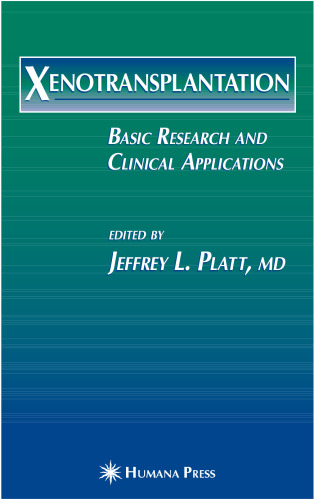 Xenotransplantation: Basic Research and Clinical Applications