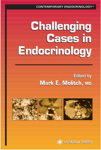 Challenging Cases in Endocrinology (Contemporary Endocrinology)