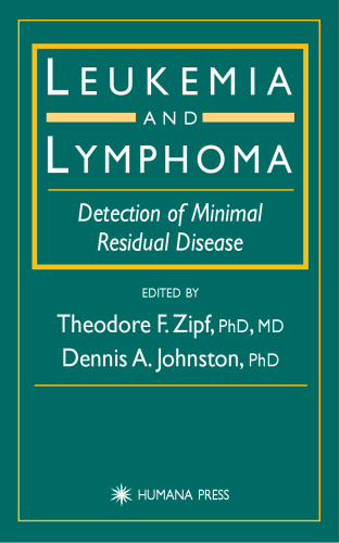 Leukemia and lymphoma : detection of minimal residual disease