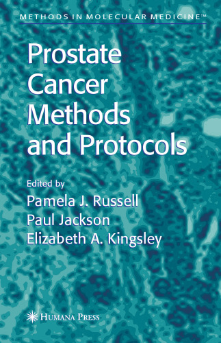 Prostate Cancer Methods and Protocols (Methods in Molecular Medicine, 81)