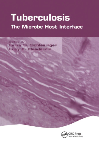 Tuberculosis: The Microbe Host Interface