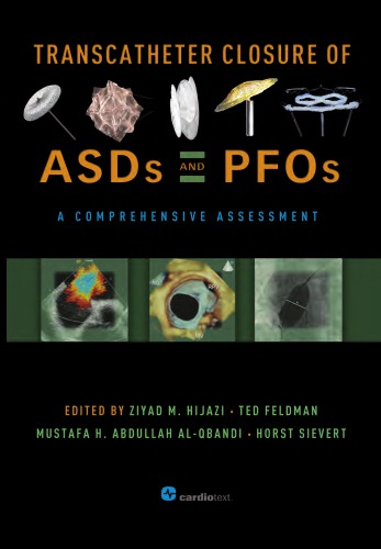 Transcatheter Closure of ASDs and PFOs: A Comprehensive Assessment