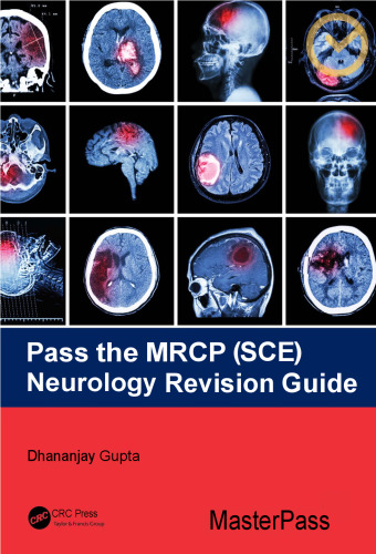 Pass the MRCP (SCE) Neurology Revision Guide (MasterPass)