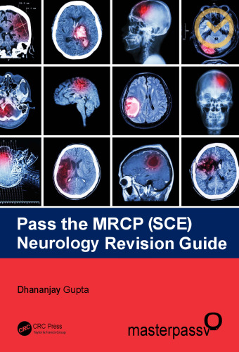 Pass the MRCP (SCE) Neurology Revision Guide (MasterPass)