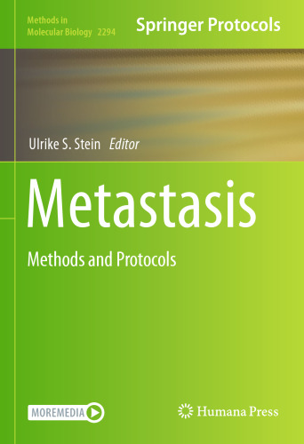 Metastasis: Methods and Protocols (Methods in Molecular Biology, 2294)