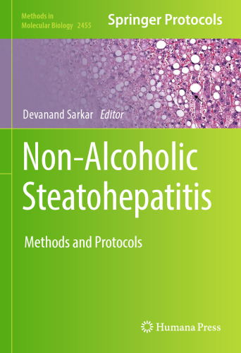 Non-Alcoholic Steatohepatitis: Methods and Protocols (Methods in Molecular Biology, 2455)