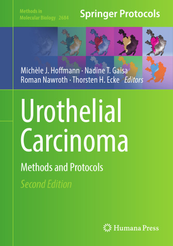 Urothelial Carcinoma: Methods and Protocols