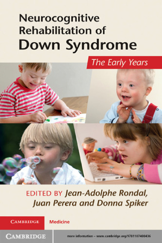 Neurocognitive Rehabilitation of Down Syndrome: Early Years