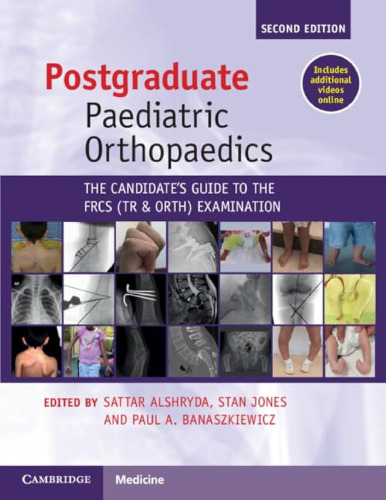 Postgraduate Paediatric Orthopaedics: The Candidate's Guide to the FRCS (Tr&Orth) Examination
