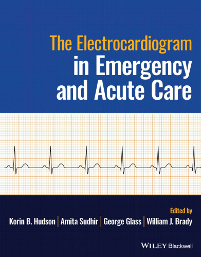The Electrocardiogram in Emergency and Acute Care