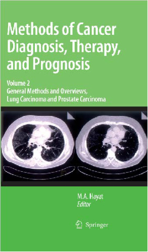 Methods of Cancer Diagnosis, Therapy and Prognosis: General Methods and Overviews, Lung Carcinoma and Prostate Carcinoma (Methods of Cancer Diagnosis, Therapy and Prognosis, Volume 2)