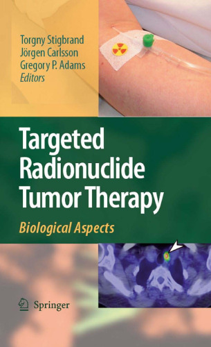 Targeted Radionuclide Tumor Therapy: Biological Aspects