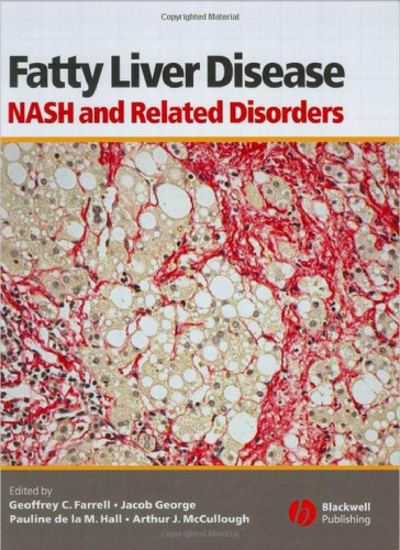 Fatty liver disease: NASH and related disorders