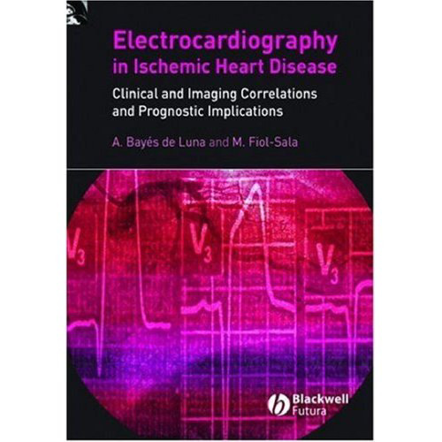 The Surface Electrocardiography in Ischemic Heart Disease: Clinical and Imaging Correlations and Prognostic Implications