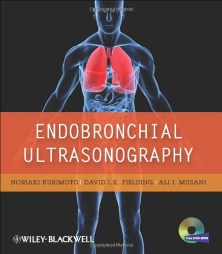 Endobronchial Ultrasonography