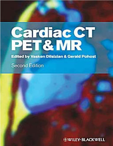 Cardiac CT, PET and MR, Second Edition