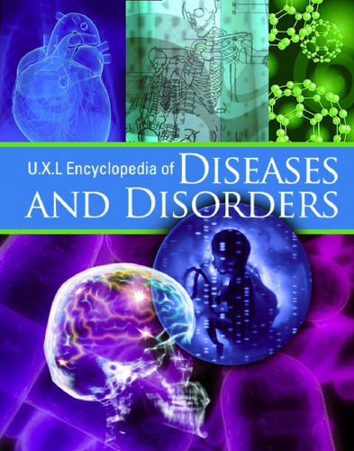 UXL Encyclopedia of Diseases and Disorders