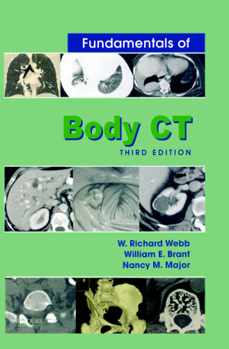 Fundamentals of Body CT, 3e