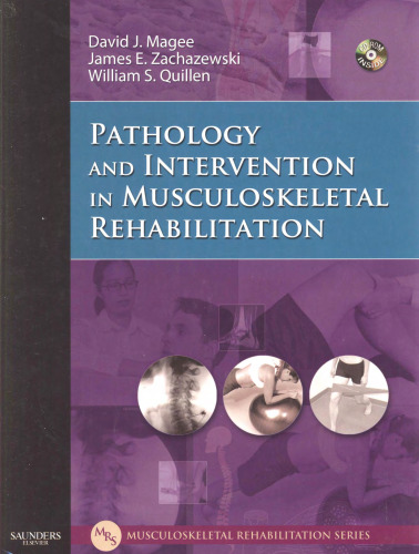 Pathology and Intervention in Musculoskeletal Rehabilitation