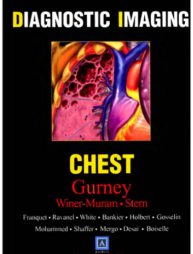 Diagnostic Imaging: Chest
