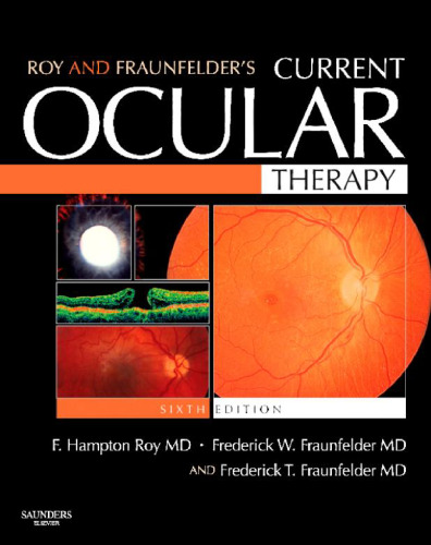 Roy and Fraunfelder's Current Ocular Therapy, 6Th Edition
