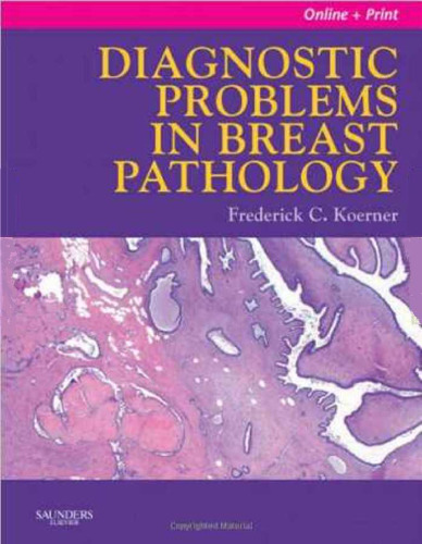 Diagnostic Problems in Breast Pathology: Expert Consult: Online and Print