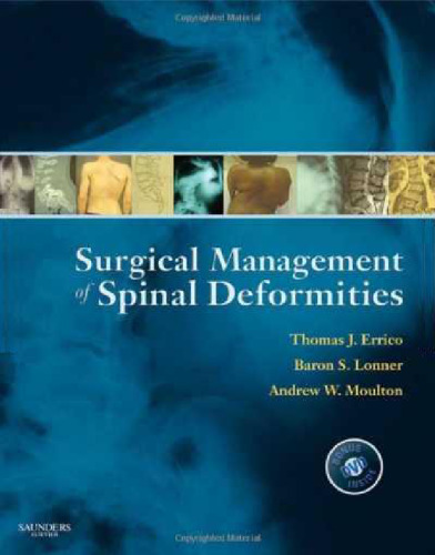 Surgical Management of Spinal Deformities