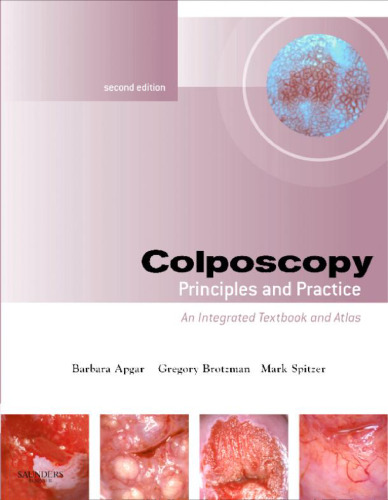 Colposcopy: Principles and Practice, Second Edition