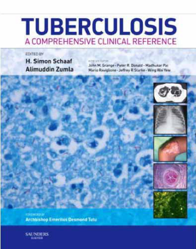 Tuberculosis: A Comprehensive Clinical Reference