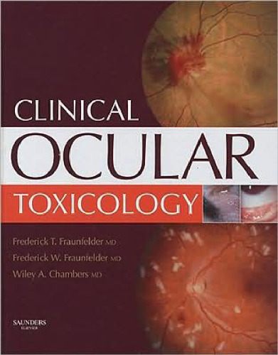Clinical Ocular Toxicology: Drug-Induced Ocular Side Effects