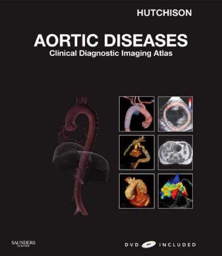 Aortic Diseases: Clinical Diagnostic Imaging Atlas (Cardiovascular Emergencies: Atlas and Multimedia)