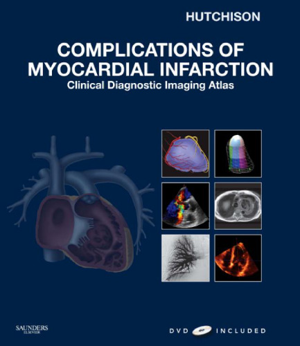 Complications of Myocardial Infarction: Clinical Diagnostic Imaging Atlas with DVD ()