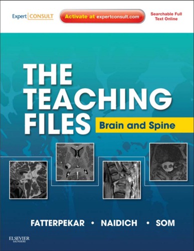 Brain and Spine