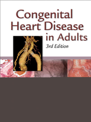 Congenital Heart Disease in Adults (Congenital Heart Disease in Adults (Perloff Child)), Third Edition