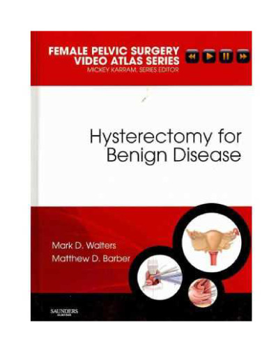 Hysterectomy for Benign Disease
